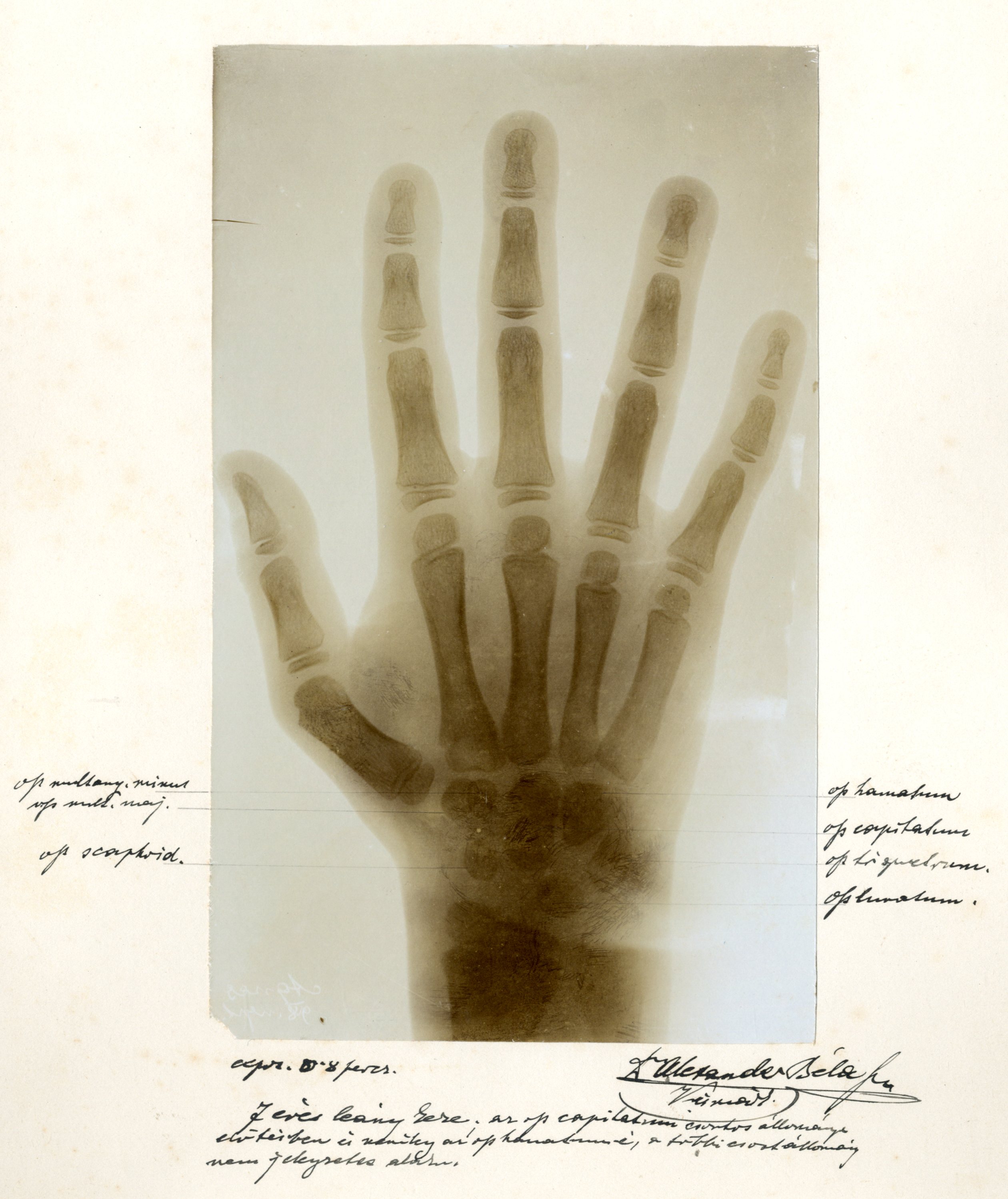 Foto č.2 röntgenovej snímky MUDr. Alexandra